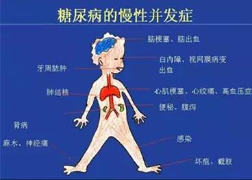 图7-1健康科普糖尿病1 图7-1健康科普糖尿病1